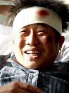 大嘴